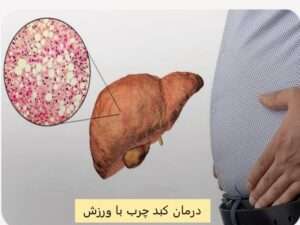 «ورزش و فعالیت بدنی برای درمان کبد چرب – تمرینات هوازی و مقاومتی»